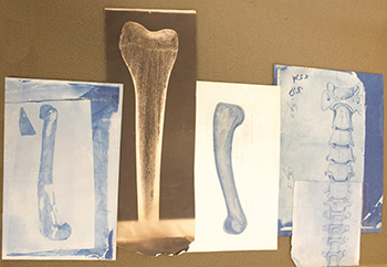 selection of natural history professor Burt Green Wilder's bone specimens